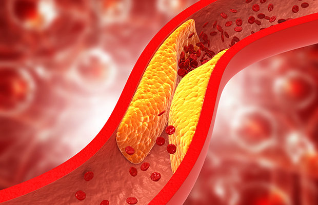 A Natural Approach to Managing Cholesterol and Triglyceride Levels