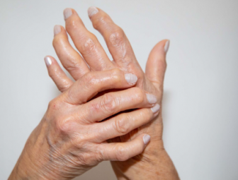 Repertorial Analysis of Rheumatoid arthritis from BBCR