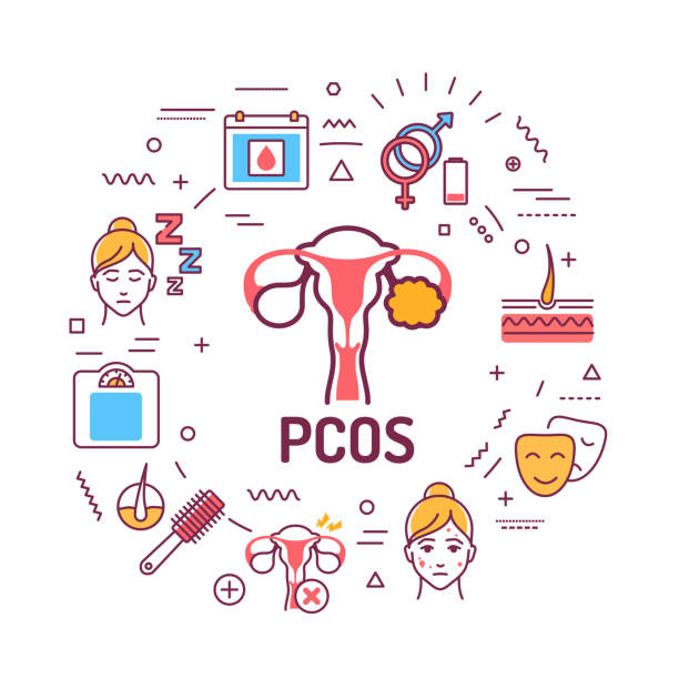 PCOS: A SOS for young girls in current scenario !