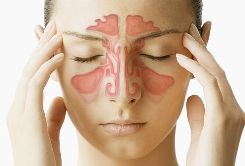 Homeopathy Medicine for Sinus Headache