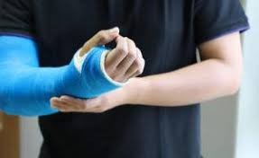 Homeopathy Medicine for Injuries & Fractures